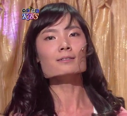 남자 사각턱 수술 효과에 대하여 성형외과 전문의가 설명드립니다. 관련 이미지 2