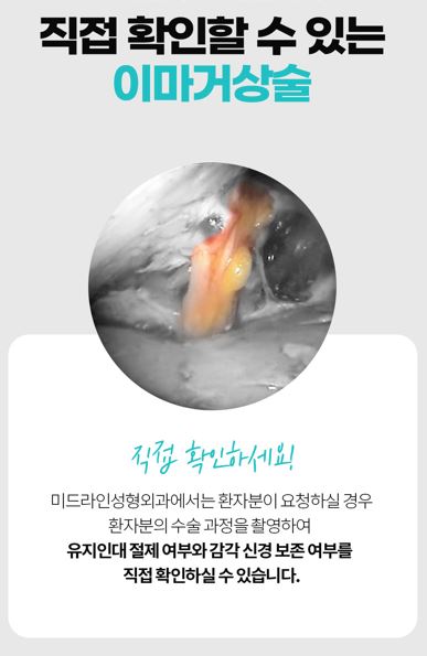 멀티 내시경이마거상술 vs 일반 이마거상술 차이점! 관련 이미지 11