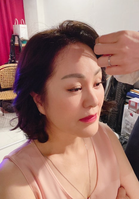 얼굴 주름 리프팅, 오래 지속되고 효과 좋은 수술방법은? 관련 이미지 13