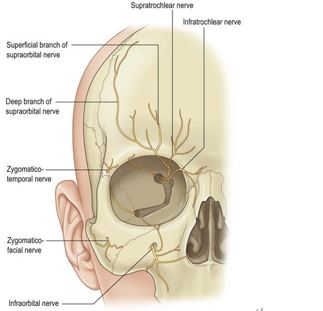 Headache, vomiting, pain, nausea after forehead lift... is it a side effect?! Here's my answer. image 7