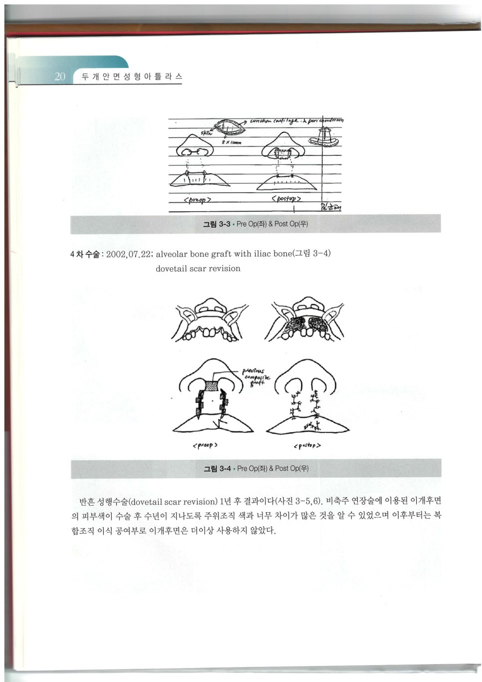 구순열 수술의 대가, 미드라인성형외과의 박병윤 교수님을 소개합니다. 관련 이미지 13