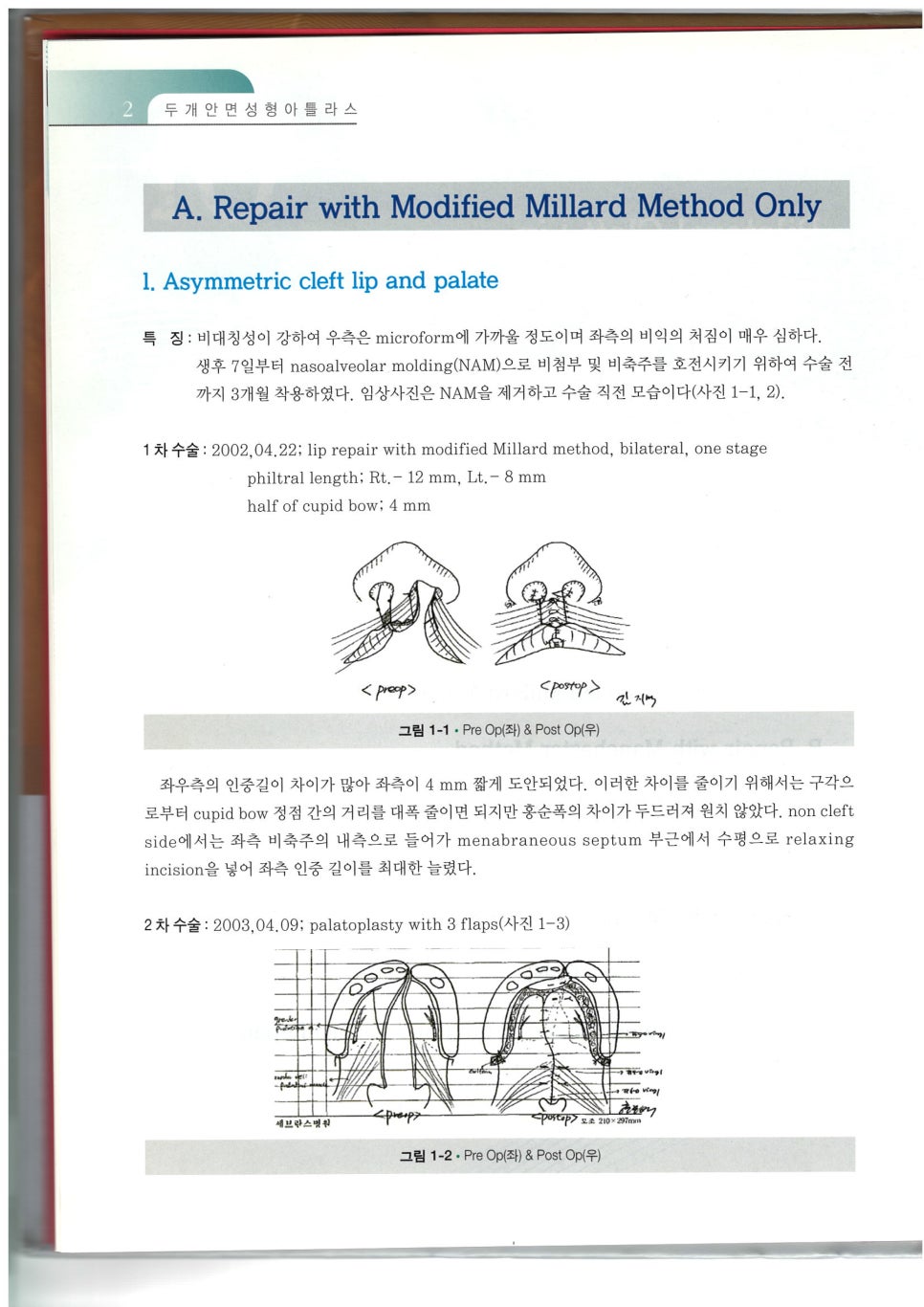 구순열 수술의 대가, 미드라인성형외과의 박병윤 교수님을 소개합니다. 관련 이미지 12