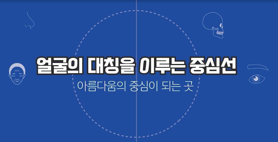 무턱 교정하면서 턱끝 비대칭(안면비대칭)까지 바로잡기! 관련 이미지 1