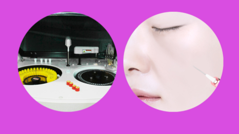 인디언 주름 고민 해결! 중안면부 리프팅에 대하여 설명드립니다. 관련 이미지 22