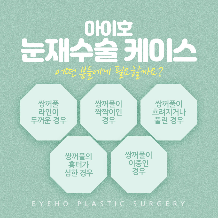 Considering the Causes of Failed Revision Eyelid Surgery Costs image 3