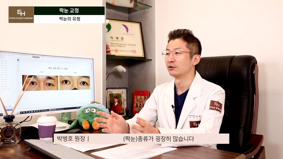 짝눈이 고민인데 양쪽 눈 수술하기 싫어요!! 한쪽 눈만 수술 가능!? 관련 이미지 2