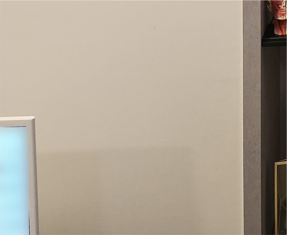 Differences Between Non-Incisional and Incisional Male Ptosis Correction Before and After image 24