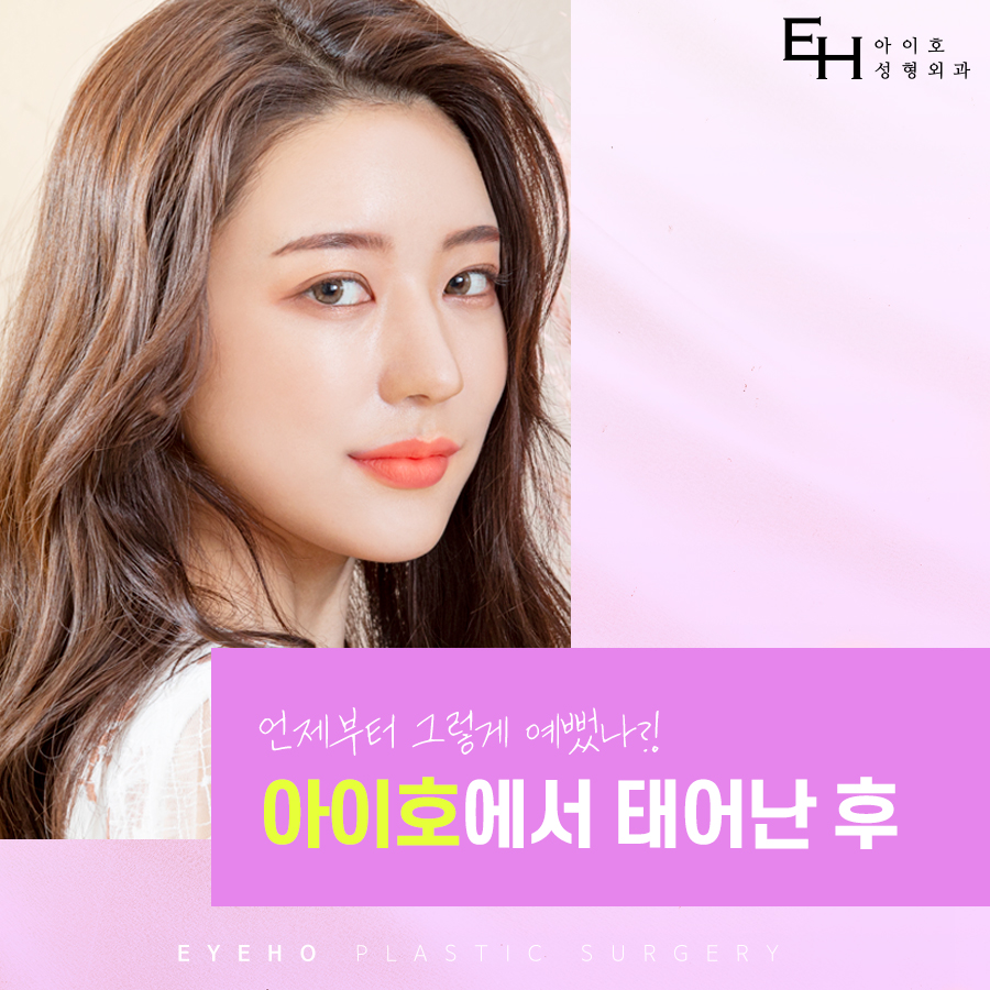 쌍꺼풀 수술 가격 및 후기 비교 분석 관련 이미지 7