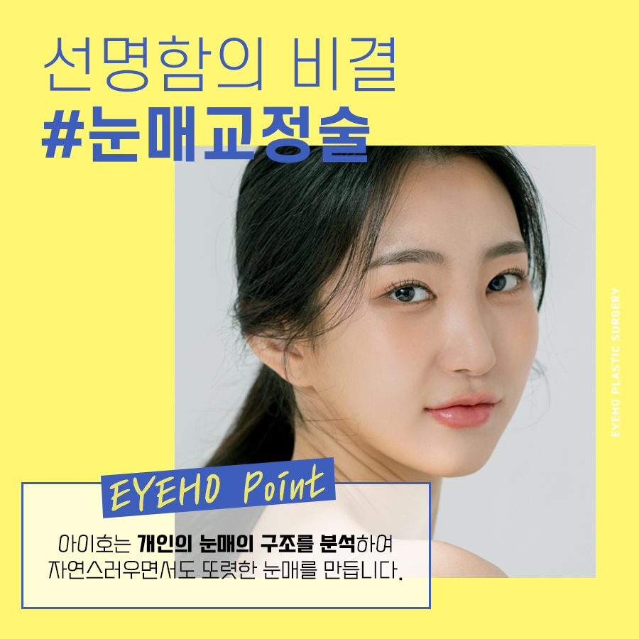 안검하수 눈매교정 졸린눈 고민 해결하자 관련 이미지 5