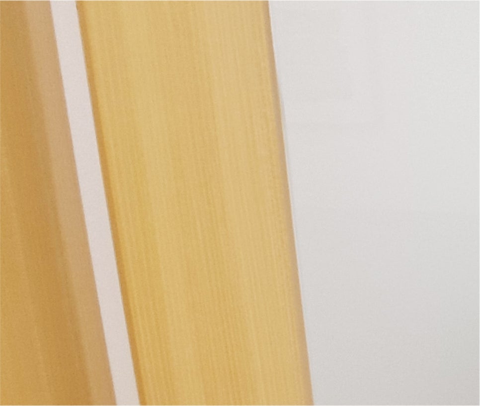 눈매교정 쌍수 : 무쌍 눈매교정 후기, 눈매교정 가격 비교 및 부작용 관련 이미지 19