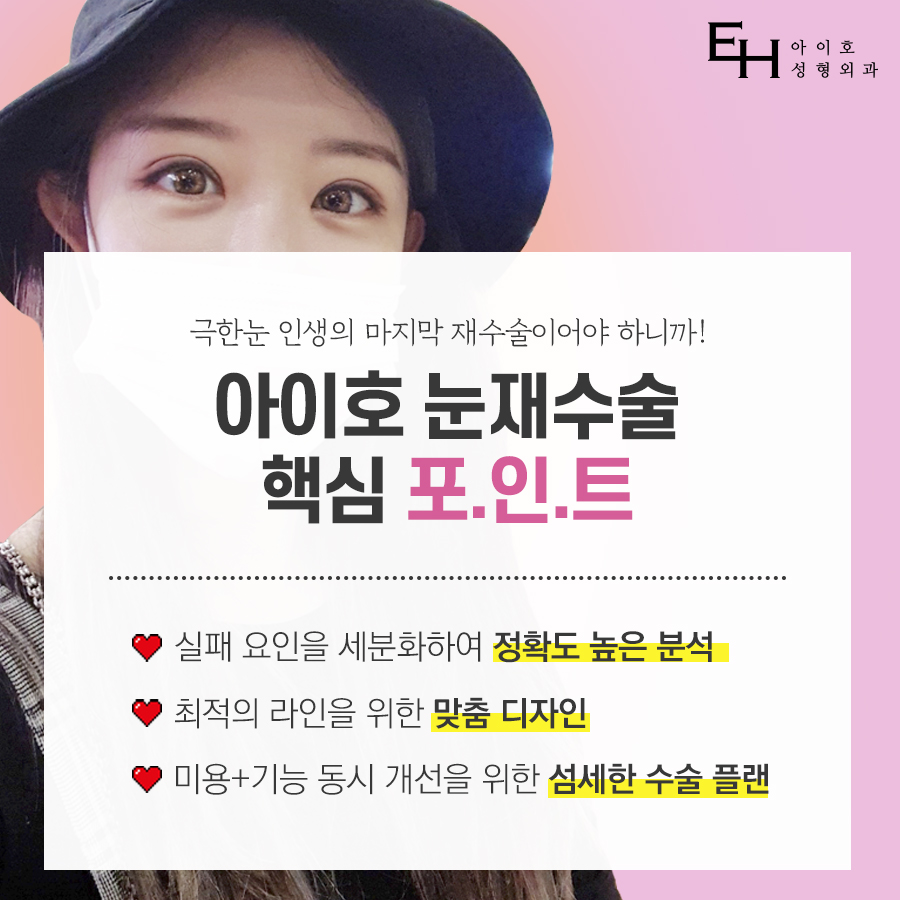 소세지눈 재수술 붓기 고민하지 않으려면 관련 이미지 5