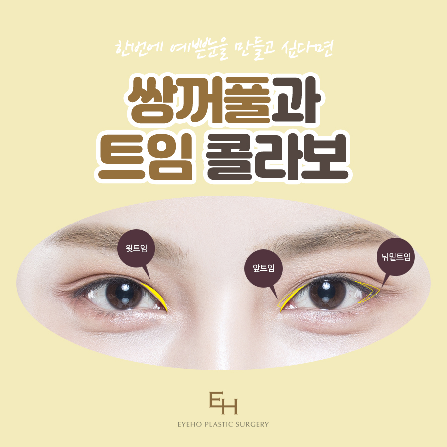 눈성형잘하는곳 아이호성형외과 관련 이미지 6