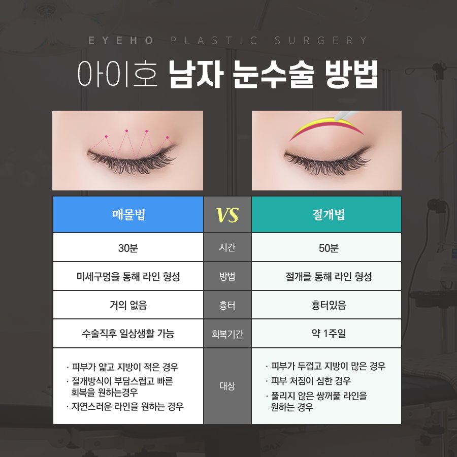 남자 눈수술 자연스럽게 잘하는곳 관련 이미지 5