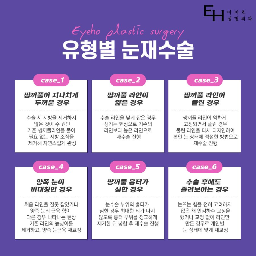 쌍꺼풀재수술비용 안심할 수 있도록 관련 이미지 2