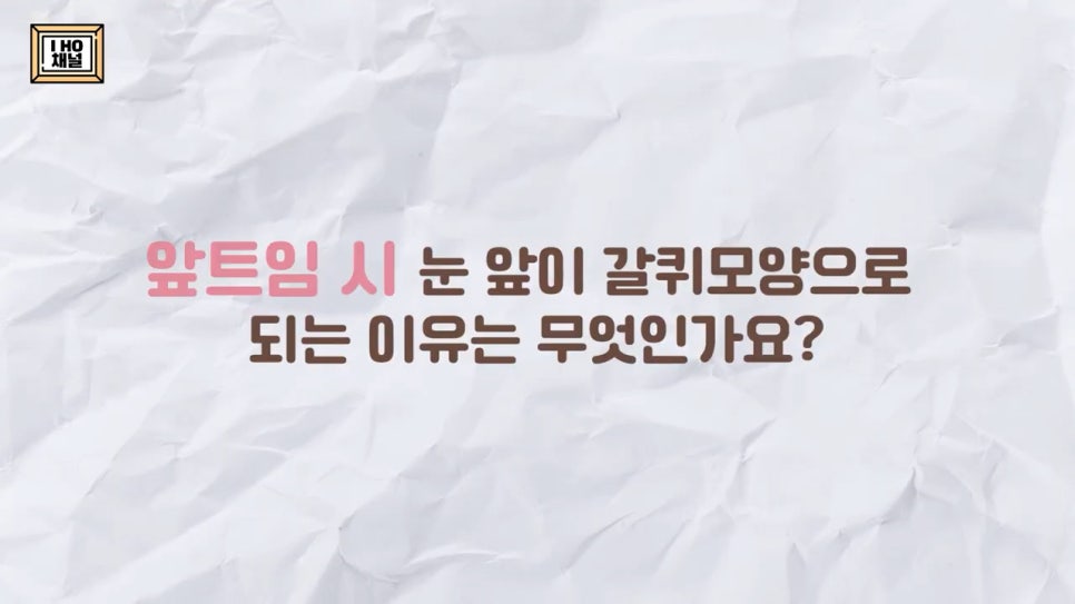 앞트임, 윗트임 하지 말아야할 눈!! 관련 이미지 40