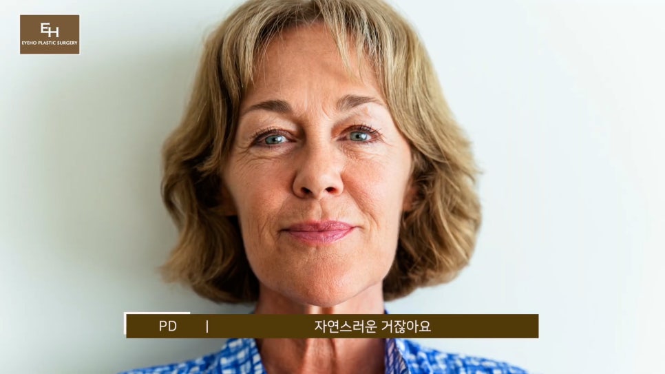 처진눈 상안검? 눈썹하거상술? 궁금하시다면 들어와!! 관련 이미지 2