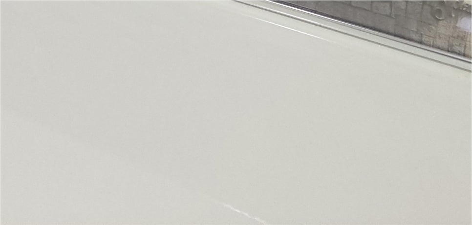 눈재수술후기 전체적인 조화를 위해 관련 이미지 22