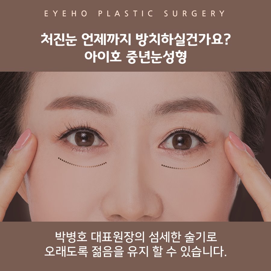 Upper Blepharoplasty for Drooping Eyes: Cost and Recovery Period image 2