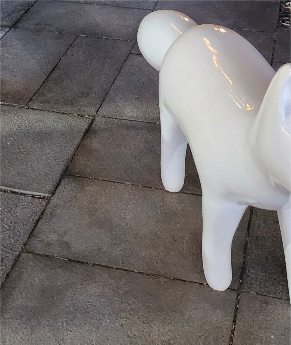하안검수술 : 눈밑처짐수술 / 하안검 수술 후기, 비용, 회복기간, 부작용 관련 이미지 21