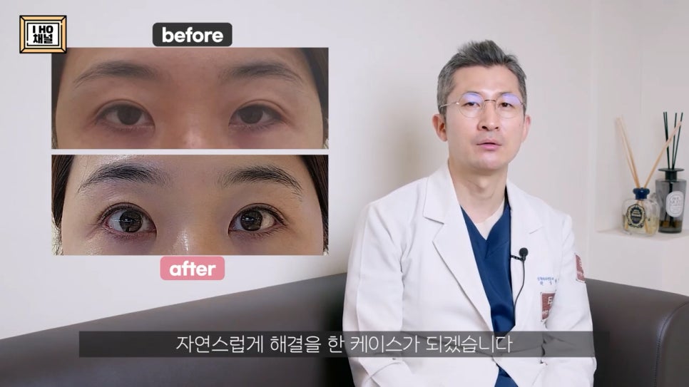 소세지눈 다 같은 게 아니다!? 유형별 재수술 방법에 대해 알려드리겠습니다. 관련 이미지 60