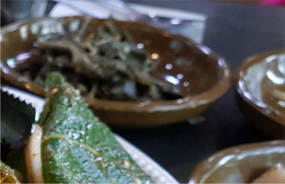 하안검 수술 후기 / 눈밑처짐수술 회복기간 관련 이미지 23