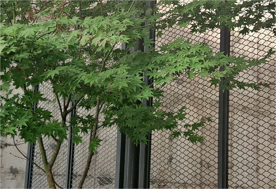 소세지눈 재수술 붓기 고민하지 않으려면 관련 이미지 18