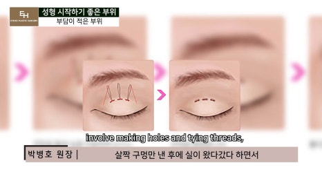 Good Things to Remember When Deciding on Your First Cosmetic Surgery image 18