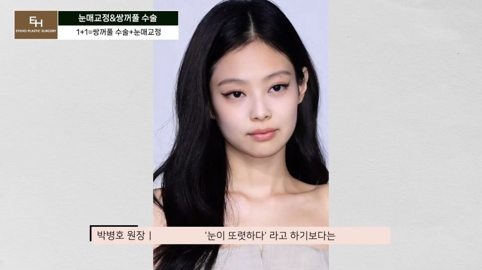 Double Eyelid Surgery and Ptosis Correction Must Be Done Together!? Here Is the Truth. image 42