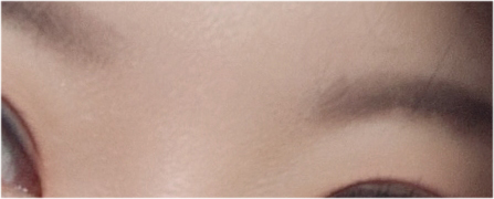 If You’re Considering Non-Incisional Eye Correction Surgery, Compare Reviews image 22