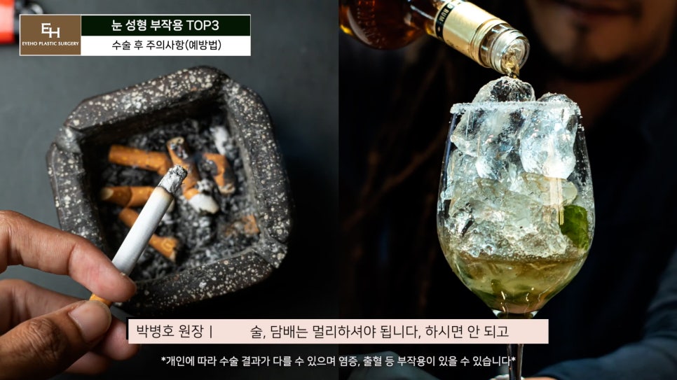 눈재수술 고민이신 분들 주목!! 관련 이미지 61