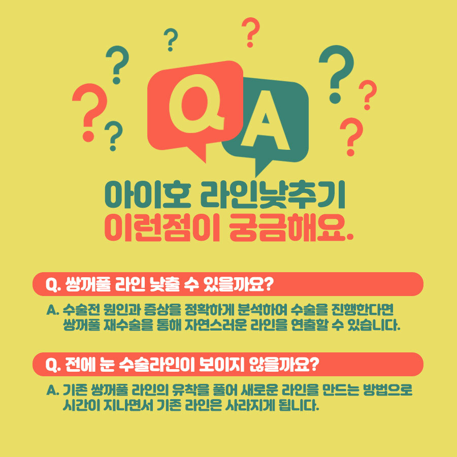 눈재수술비용 어떨때 개선해야 하나요? 관련 이미지 7