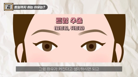 Do Double Eyelid Surgery and Canthoplasty Have to Be Done Together? image 7