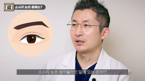 소세지눈 다 같은 게 아니다!? 유형별 재수술 방법에 대해 알려드리겠습니다. 관련 이미지 2