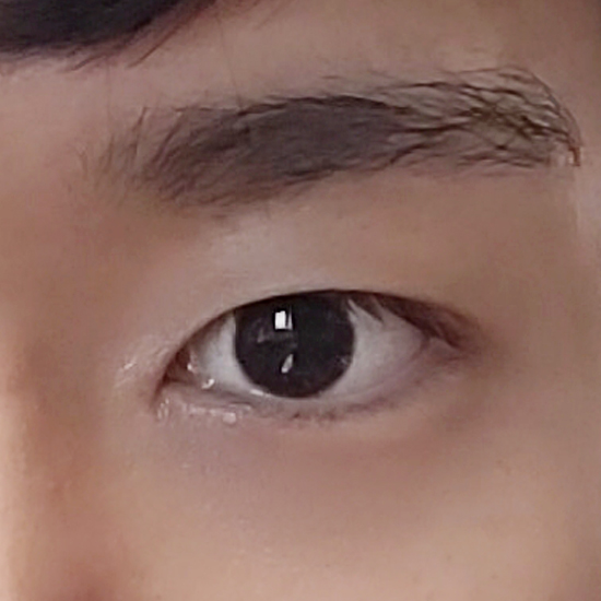 남자 눈수술 자연스럽게 잘하는곳 관련 이미지 1