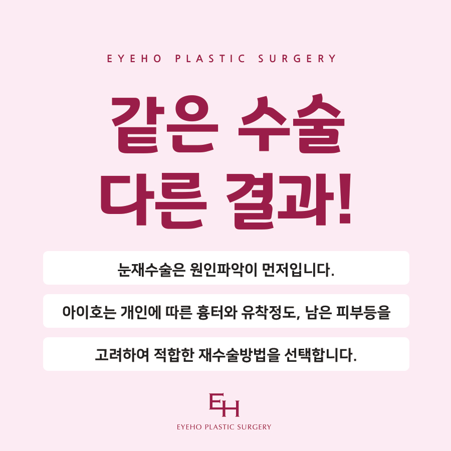 쌍수 눈재수술 비용 및 한쪽 재수술 / 짝눈 재수술 방법 공유 관련 이미지 7