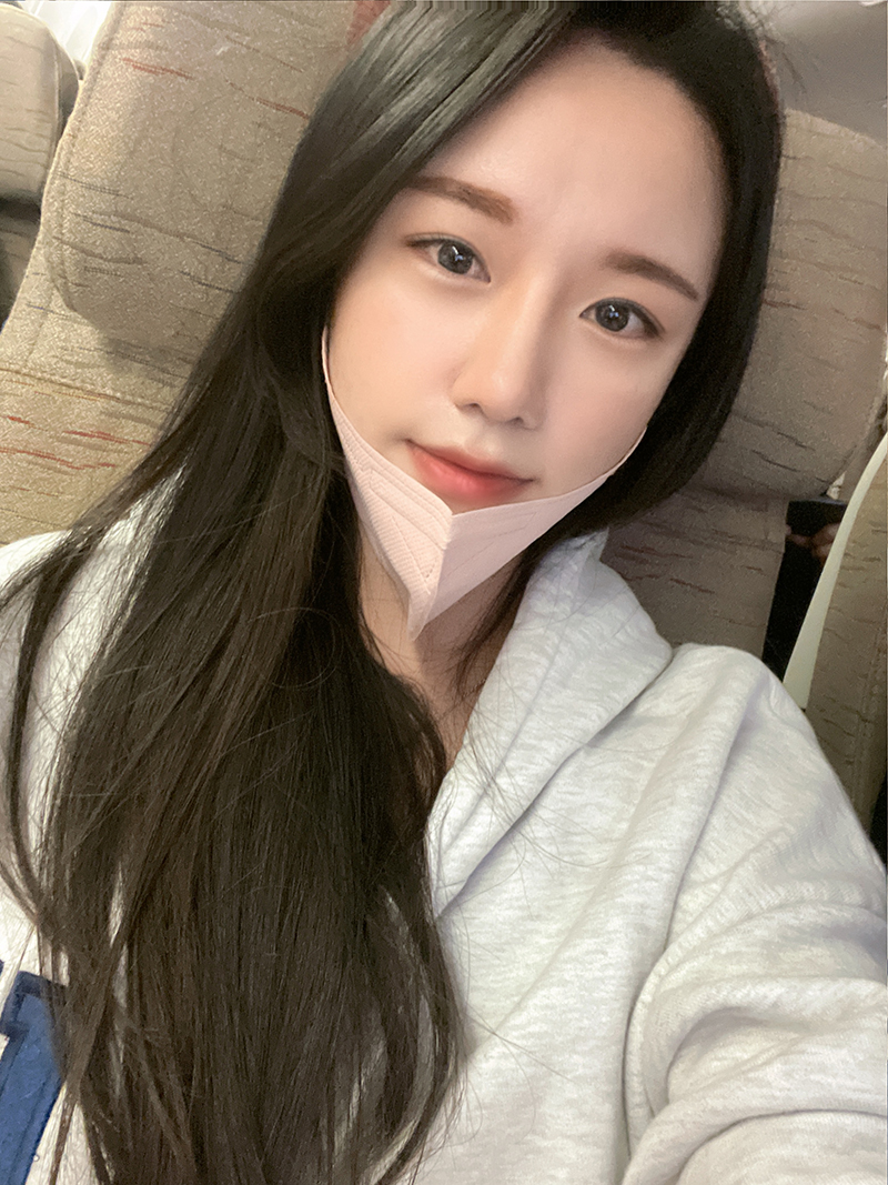 눈성형전후 꼼꼼하게 비교해서 관련 이미지 14