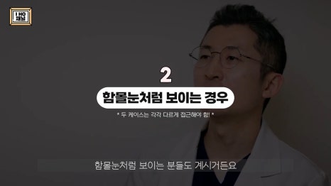 함몰눈 드라마틱한 결과를 얻는 방법은 따로 있다. 관련 이미지 5