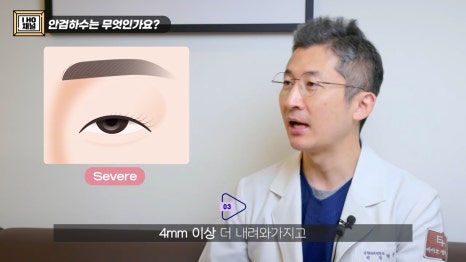 Can Eye Correction Surgery to Improve Ptosis Be Done for Everyone Who Has Trouble Opening Their Eyes? image 8