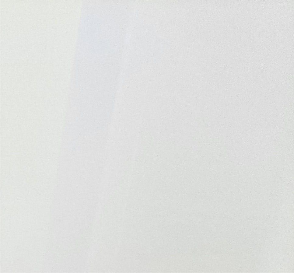 눈재수술 마지막이 되려면 눈전문성형외과에서 관련 이미지 15