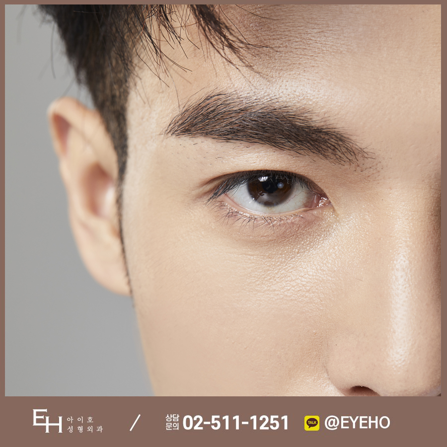If You’re Looking Into Buried Double Eyelid Surgery and Epicanthoplasty Because You Want to Look Handsome!? image 1