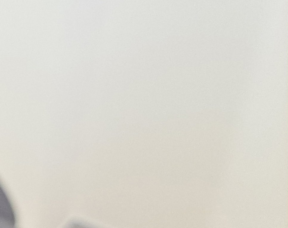 [눈성형종류] 눈찝기 풀어질 확률을 줄이고 싶다면 관련 이미지 20