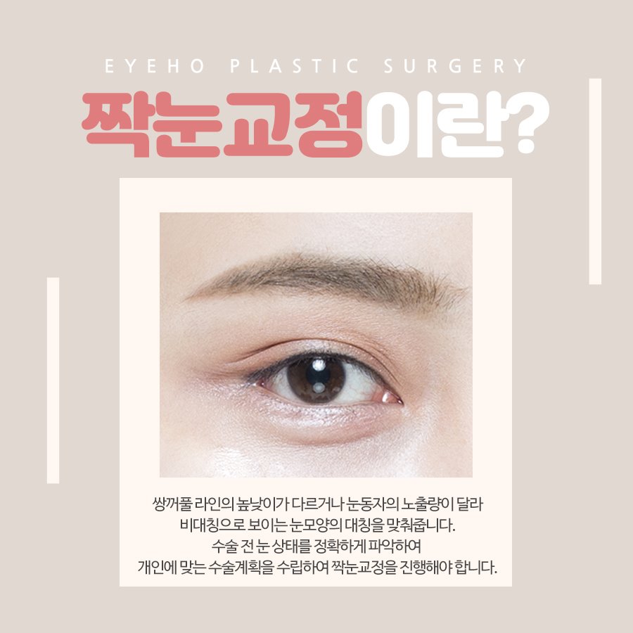 비대칭 짝눈교정 한쪽눈성형으로 대칭을 이루세요. 관련 이미지 2