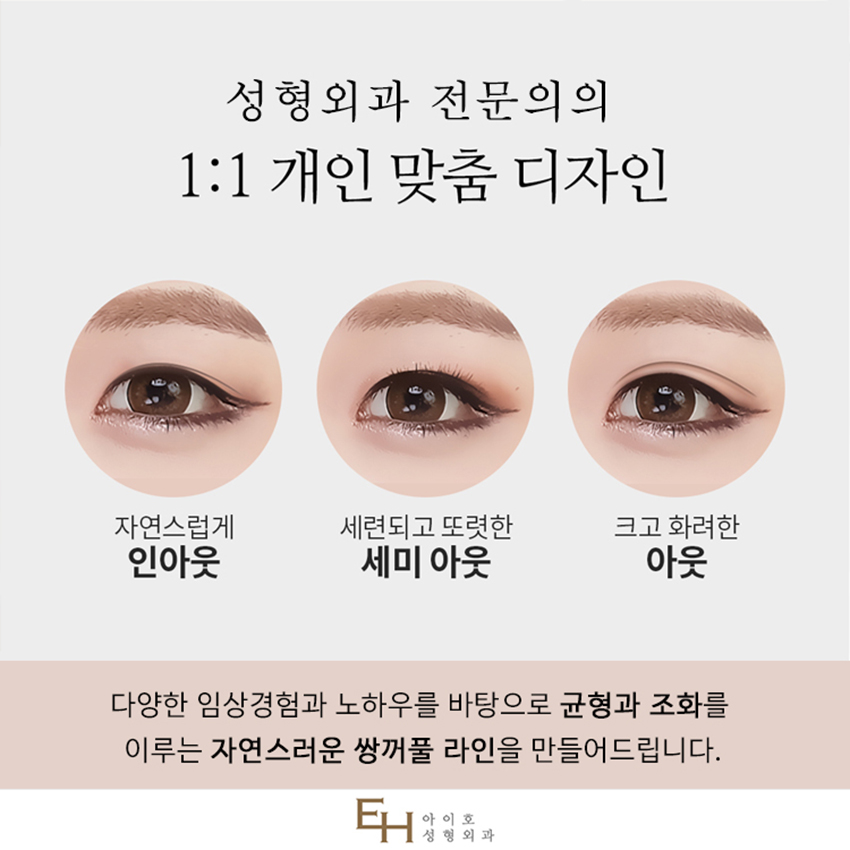 Double Eyelid Revision Surgery Cost: Check Everything Carefully, Including the Results image 3