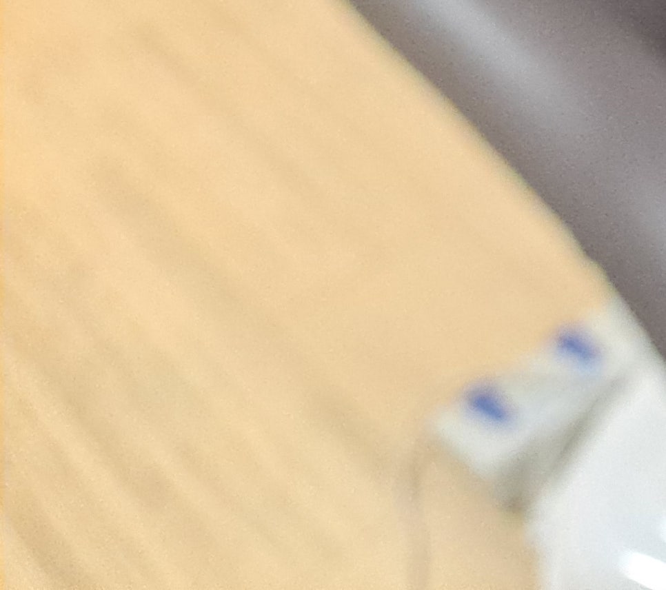 [눈성형종류] 눈찝기 풀어질 확률을 줄이고 싶다면 관련 이미지 21