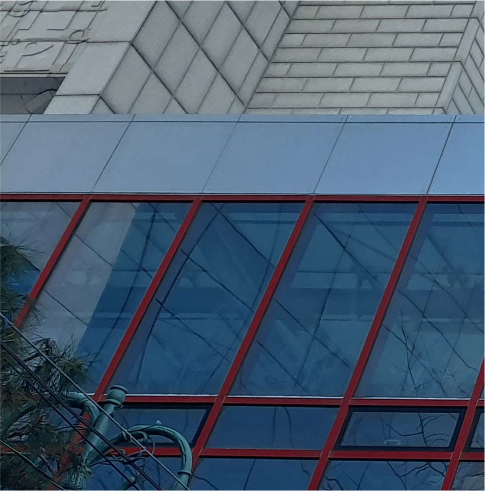 남자눈매교정전후 세세하게 파악해보면서 관련 이미지 18