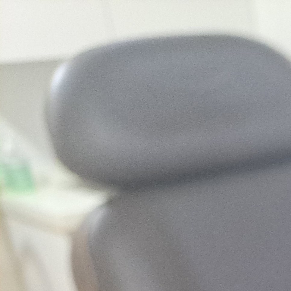 [눈성형종류] 눈찝기 풀어질 확률을 줄이고 싶다면 관련 이미지 15