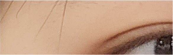 쌍수매몰법 매력적인 나만의 라인으로 관련 이미지 21