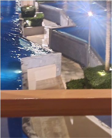눈성형전후 디테일까지 꼼꼼하게 비교 관련 이미지 24