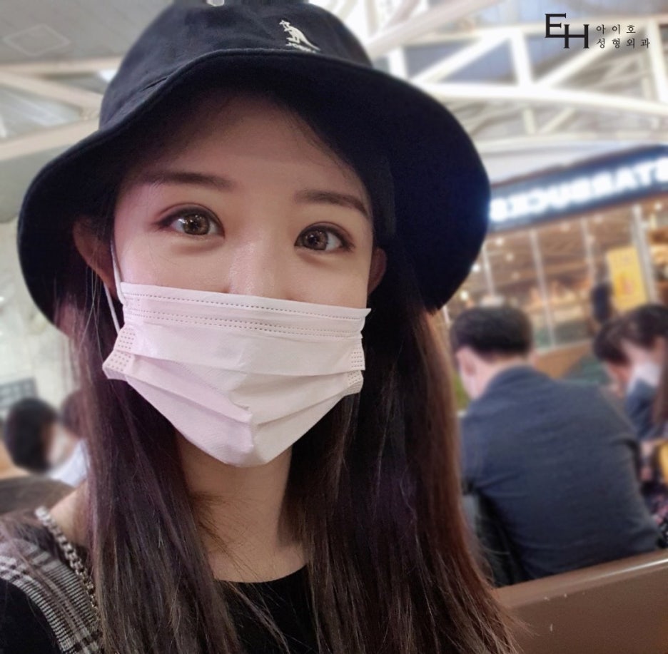 눈매교정가격 체크해야 할 정보는 관련 이미지 1