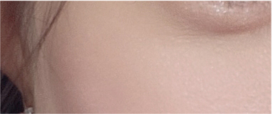 If You’re Considering Non-Incisional Eye Correction Surgery, Compare Reviews image 24